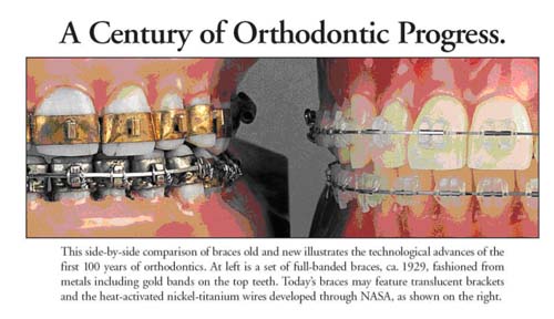 A Century of Orthodontic Progress